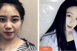 株洲嘉美醫(yī)療整形美容診所李智生整形價(jià)格表附鼻部綜合案例展示