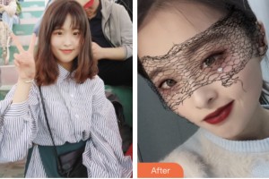 株洲中雅醫(yī)療美容門診部喻欣整形價(jià)格表附肋軟骨隆鼻案例展示