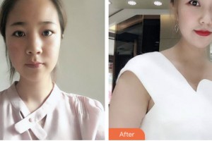 株洲希美醫(yī)療美容門診部唐會勇整形價(jià)格表附鼻部綜合案例展示