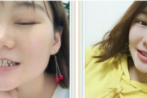 泰州泰勒美整形美容醫(yī)院艾竹林整形價(jià)格表附口腔牙齒矯正案例展示