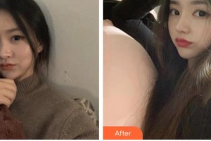 泰州麗都醫(yī)療美容醫(yī)院韓相俊整形價(jià)格表附硅膠隆鼻案例展示