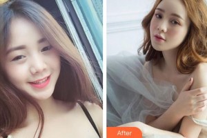 泰州麗都醫(yī)療美容醫(yī)院李艷整形價(jià)格表附眼部綜合案例展示