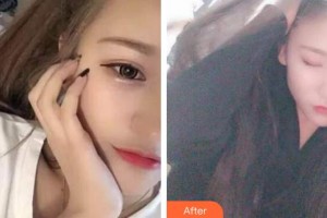 泰州拜博口腔醫(yī)院李文文整形價(jià)格表附冷光美白案例展示