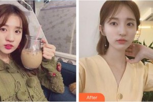 湘潭市中心醫(yī)院醫(yī)學整形美容科李為儒整形價格表附鼻部綜合案例展示