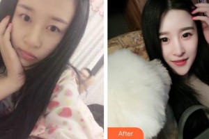 湘潭市紅十字仁和醫(yī)院整形美容中心譚可意整形價格表附鼻部綜合案例展示