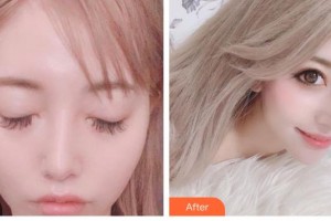 湘潭華美整形醫(yī)院譚兵整形價格表附鼻部綜合案例展示