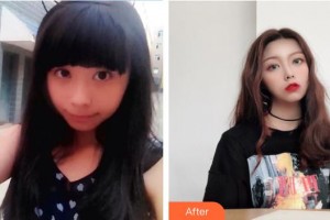 湘潭雅美醫(yī)療美容醫(yī)院白果整形價格表附鼻部綜合案例展示