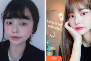 湘潭市中心醫(yī)院醫(yī)學整形美容科周牡丹整形價格表附眼部綜合案例展示