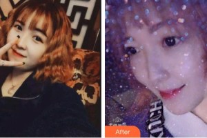 永州國斌口腔門診部李國斌整形價格表附超聲波潔牙案例展示