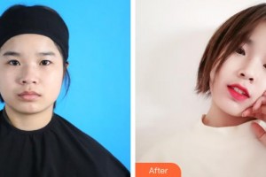 榆林愛(ài)爾眼科醫(yī)院蘇榆生整形價(jià)格表附眼部綜合案例展示