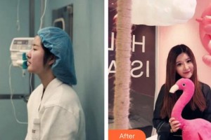 天水瑪莉亞（原女子）醫(yī)院醫(yī)學(xué)整形中心李曉愛(ài)整形價(jià)格表附鼻部綜合案例展示