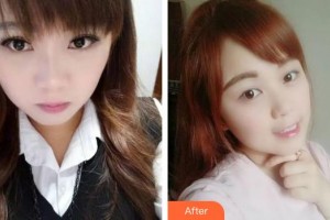 天水瑪莉亞（原女子）醫(yī)院醫(yī)學(xué)整形中心金東振整形價(jià)格表附牙齒隱形矯正案例展示