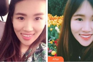 天水瑪莉亞（原女子）醫(yī)院醫(yī)學(xué)整形中心李兆鶴整形價(jià)格表附牙齒隱形矯正案例展示