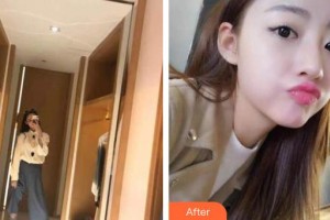 天水市中西醫(yī)結(jié)合醫(yī)院口腔頜面外科萬(wàn)小衛(wèi)整形價(jià)格表附牙齒隱形矯正案例展示