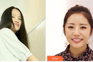 天水市中西醫(yī)結(jié)合醫(yī)院口腔頜面外科盧軍勝整形價(jià)格表附牙齒隱形矯正案例展示