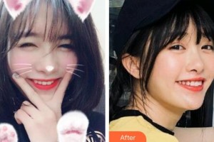 天水市中西醫(yī)結(jié)合醫(yī)院口腔頜面外科丁艷美整形價(jià)格表附冷光美白案例展示