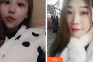 天水市中西醫(yī)結(jié)合醫(yī)院口腔頜面外科趙瓊整形價(jià)格表附自鎖托槽矯正案例展示