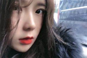 沈陽(yáng)杏林整形醫(yī)院朱石江頜面手術(shù)果好不好附果分享