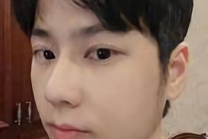 暨南大學(xué)附屬深圳華僑醫(yī)院季如恭下頜角整形怎么樣？附術(shù)后對比圖