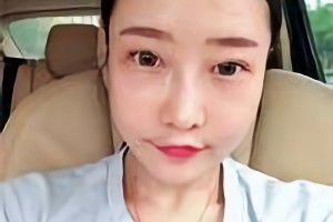 華西口腔醫(yī)院李運(yùn)峰磨骨手術(shù)價(jià)格貴嗎？附價(jià)格表和案例