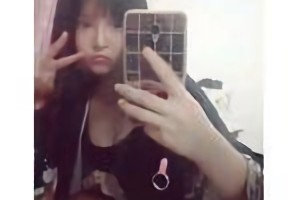 上海華美醫(yī)院李志海做的下頜角貴嗎？附案例日記分享