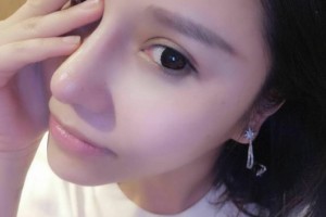 同濟大學附屬東方醫(yī)院醫(yī)生團隊如何？附隆鼻手術附果圖展示