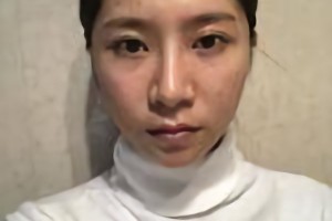 上海仁愛醫(yī)院劉先超磨骨怎么樣？附案例分享和較新價格表