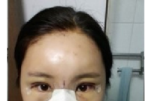 上海大附屬九院整形科如何？附實(shí)拍案例+醫(yī)生介紹