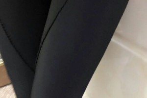 北京石景山八大處中西醫(yī)結合醫(yī)院正規(guī)嗎吸脂瘦腿手術附果圖