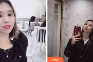 郴州市第四人民醫(yī)院曹慧芬整形價(jià)格表附無(wú)針?biāo)獍咐故?>
</a>
<h3 class=