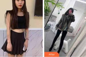 郴州美科醫(yī)療美容門診部彭奪斌整形價格表附激光祛疤案例展示