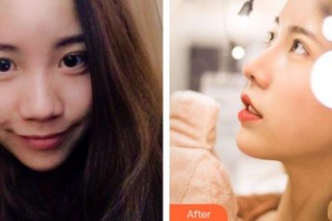 郴州冠華口腔醫(yī)院宋麗沙整形價格表附鼻部綜合案例展示