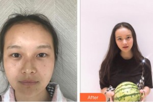 樂清牙科醫(yī)院黃鴿整形價(jià)格表附牙貼面案例展示