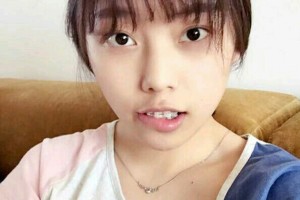 武漢第一口腔醫(yī)院怎么樣牙齒矯正果好不好附果圖和價格表