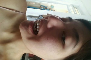 歡樂口腔醫(yī)院孫延牙齒矯正？醫(yī)生推薦+費(fèi)用表