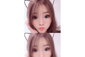 鄭州天后整形醫(yī)院割雙眼皮貴不貴附價格一覽