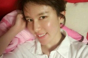 北京同仁醫(yī)院牙齒矯正貴不貴附案例和價格表