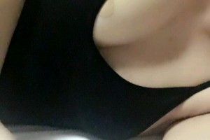 西安畫美醫(yī)療美容醫(yī)院硬件設(shè)施怎么樣芮浩隆胸手術(shù)附果圖