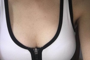 鄭州大學(xué)附屬醫(yī)院整形外科口碑好不好陳言湯隆胸案例附價格一覽