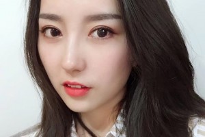 上海星璨國際整形硬件設施怎么樣張勍楓隆鼻手術好不好附案例