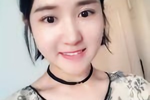 杭州時光代醫(yī)療美容醫(yī)院河東鎬磨骨果怎么樣？附案例分享和價格表