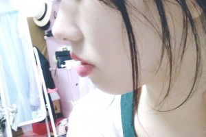 上海中博口腔醫(yī)院劉建勛牙齒矯正果好不好附案例對比和價格一覽