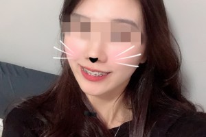 北京深圳大學醫(yī)院環(huán)境怎么樣牙齒矯正果分享附價格一覽