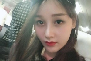 臺(tái)州椒江維多利亞整形美容門診部魏萍隆鼻手術(shù)附果圖分享