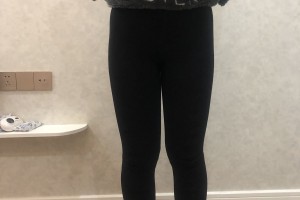 湖南省人民醫(yī)院整形醫(yī)院李高峰吸脂瘦腿果太棒了附2021價格表