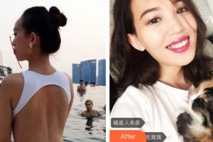 雞西王醫(yī)生整形外科門診部郝國梁整形價格表附牙齒陶瓷矯正案例展示