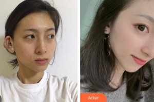 宜興市皮膚病醫(yī)院醫(yī)療美容科談君林整形價格表附微創(chuàng)疤痕修復(fù)案例展示