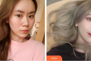 邯鄲中信皮膚科門診部武賀慶整形價格表附眼部綜合案例展示