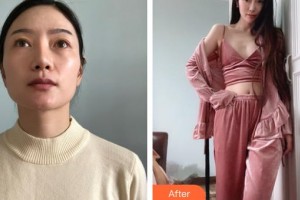 邯鄲市眼科醫(yī)院趙邯英整形價格表附外切祛眼袋案例展示