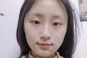 北京圣嘉榮醫(yī)療美容醫(yī)院口碑怎么樣？附案例分享|醫(yī)生推薦